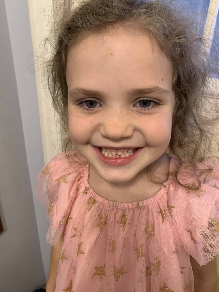 girl with her first loose tooth on the bottom